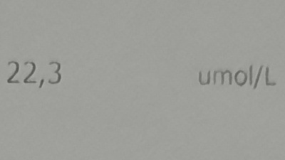 Photograph of my 2019 blood iron result that shows an normal result
