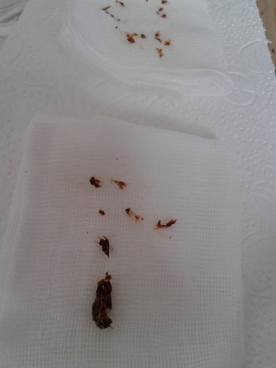 Left ear earwax 18 June 2019
